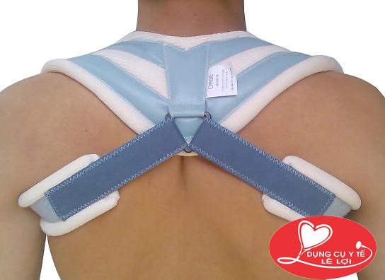 Biện pháp bất động xương đòn bị gãy
