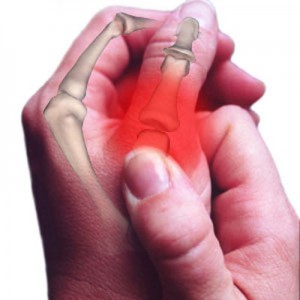 Biến chứng xương khớp ở bệnh nhân đái tháo đường